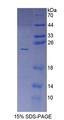 TS / Thromboxane Synthase Protein - Recombinant  Cytochrome P450 5A1 By SDS-PAGE