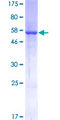 TS / Thymidylate Synthase Protein - 12.5% SDS-PAGE of human TYMS stained with Coomassie Blue