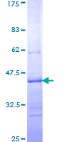 TS / Thymidylate Synthase Protein - 12.5% SDS-PAGE Stained with Coomassie Blue.