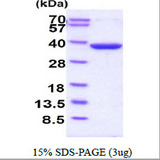 TS / Thymidylate Synthase Protein