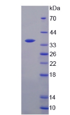 TS / Thymidylate Synthase Protein - Recombinant  Thymidylate Synthetase By SDS-PAGE