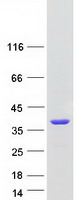 TS / Thymidylate Synthase Protein - Purified recombinant protein TYMS was analyzed by SDS-PAGE gel and Coomassie Blue Staining