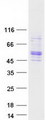 TSAP6 / STEAP3 Protein - Purified recombinant protein STEAP3 was analyzed by SDS-PAGE gel and Coomassie Blue Staining