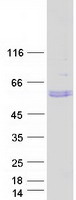 TSAP6 / STEAP3 Protein - Purified recombinant protein STEAP3 was analyzed by SDS-PAGE gel and Coomassie Blue Staining