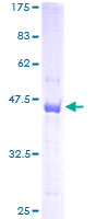 TSC22D1 / TSC22 Protein - 12.5% SDS-PAGE of human TSC22D1 stained with Coomassie Blue