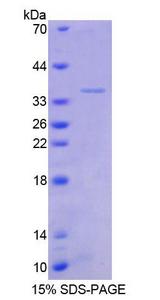 TSC22D1 / TSC22 Protein - Recombinant  Transforming Growth Factor Beta Stimulated Protein Clone 22 By SDS-PAGE