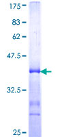 TSC22D2 Protein - 12.5% SDS-PAGE Stained with Coomassie Blue.
