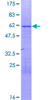 TSC22D3 / GILZ Protein - 12.5% SDS-PAGE of human TSC22D3 stained with Coomassie Blue
