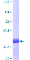 TSC22D3 / GILZ Protein - 12.5% SDS-PAGE Stained with Coomassie Blue.