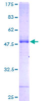 TSC501 / NAT8 Protein - 12.5% SDS-PAGE of human NAT8 stained with Coomassie Blue