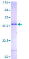 TSC501 / NAT8 Protein - 12.5% SDS-PAGE of human NAT8 stained with Coomassie Blue