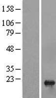 TSEN15 Protein - Western validation with an anti-DDK antibody * L: Control HEK293 lysate R: Over-expression lysate