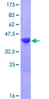 TSEN15 Protein - 12.5% SDS-PAGE of human C1orf19 stained with Coomassie Blue