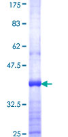 TSEN15 Protein - 12.5% SDS-PAGE Stained with Coomassie Blue.