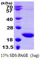 TSEN15 Protein