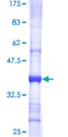TSEN2 Protein - 12.5% SDS-PAGE Stained with Coomassie Blue.