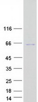 TSEN2 Protein - Purified recombinant protein TSEN2 was analyzed by SDS-PAGE gel and Coomassie Blue Staining