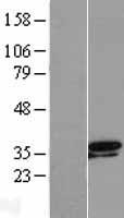 TSEN34 Protein - Western validation with an anti-DDK antibody * L: Control HEK293 lysate R: Over-expression lysate