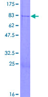 TSEN34 Protein - 12.5% SDS-PAGE of human TSEN34 stained with Coomassie Blue