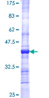 TSEN34 Protein - 12.5% SDS-PAGE Stained with Coomassie Blue.