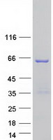 TSEN54 Protein - Purified recombinant protein TSEN54 was analyzed by SDS-PAGE gel and Coomassie Blue Staining