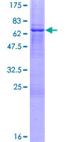 TSFM Protein - 12.5% SDS-PAGE of human TSFM stained with Coomassie Blue