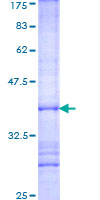 TSFM Protein - 12.5% SDS-PAGE Stained with Coomassie Blue.