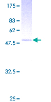 TSG / TWSG1 Protein - 12.5% SDS-PAGE of human TWSG1 stained with Coomassie Blue