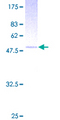 TSG / TWSG1 Protein - 12.5% SDS-PAGE of human TWSG1 stained with Coomassie Blue