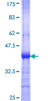 TSG / TWSG1 Protein - 12.5% SDS-PAGE Stained with Coomassie Blue.