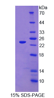 TSG / TWSG1 Protein - Recombinant Twisted Gastrulation Protein Homolog 1 By SDS-PAGE