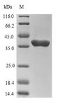 TSG101 Protein - (Tris-Glycine gel) Discontinuous SDS-PAGE (reduced) with 5% enrichment gel and 15% separation gel.