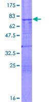 TSG101 Protein - 12.5% SDS-PAGE of human TSG101 stained with Coomassie Blue