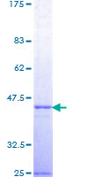 TSG101 Protein - 12.5% SDS-PAGE Stained with Coomassie Blue.