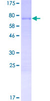 TSGA10IP Protein - 12.5% SDS-PAGE of human TSGA10IP stained with Coomassie Blue