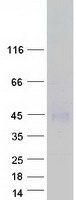 TSH Receptor / TSHR Protein - Purified recombinant protein TSHR was analyzed by SDS-PAGE gel and Coomassie Blue Staining