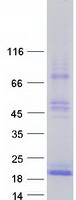 TSHB / TSH-Beta Protein - Purified recombinant protein TSHB was analyzed by SDS-PAGE gel and Coomassie Blue Staining