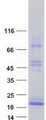 TSHB / TSH-Beta Protein - Purified recombinant protein TSHB was analyzed by SDS-PAGE gel and Coomassie Blue Staining