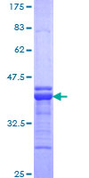 TSHZ1 Protein - 12.5% SDS-PAGE Stained with Coomassie Blue.
