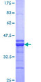 TSHZ1 Protein - 12.5% SDS-PAGE Stained with Coomassie Blue.