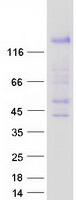 TSHZ3 Protein - Purified recombinant protein TSHZ3 was analyzed by SDS-PAGE gel and Coomassie Blue Staining