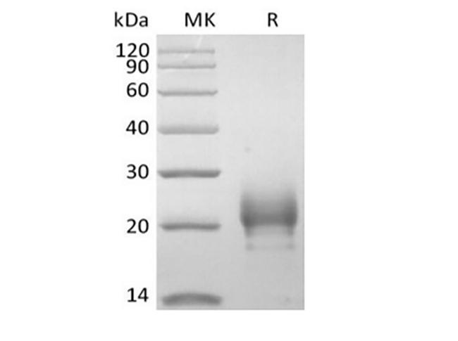 TSLP Protein - Recombinant Human Thymic Stromal Lymphopoietin/TSLP (R127A, R130A, C-10His)