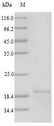 TSLP Protein - (Tris-Glycine gel) Discontinuous SDS-PAGE (reduced) with 5% enrichment gel and 15% separation gel.