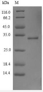 TSLP Protein - (Tris-Glycine gel) Discontinuous SDS-PAGE (reduced) with 5% enrichment gel and 15% separation gel.