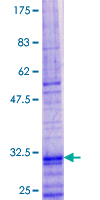 TSLP Protein - 12.5% SDS-PAGE of human TSLP stained with Coomassie Blue