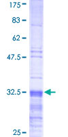 TSLP Protein - 12.5% SDS-PAGE Stained with Coomassie Blue.