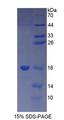 TSLP Protein - Recombinant  Thymic Stromal Lymphopoietin By SDS-PAGE