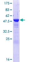 TSN / Translin Protein - 12.5% SDS-PAGE of human TSN stained with Coomassie Blue