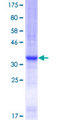 TSN / Translin Protein - 12.5% SDS-PAGE Stained with Coomassie Blue.