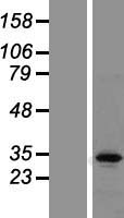 TSNAX / TRAX Protein - Western validation with an anti-DDK antibody * L: Control HEK293 lysate R: Over-expression lysate